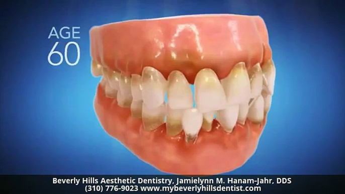 Invisalign Dentist Beverly Hills CA