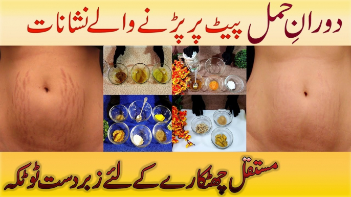 Remove Pregnancy Stretch Marks Home Remedies - Get Rid of Stretch Marks Permanently Urdu Hindi