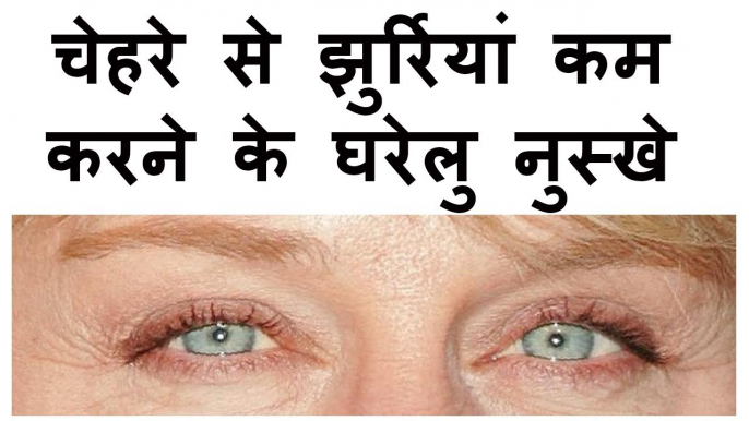 Pimple Scars and Acne - Home  चेहरे की झुर्रियां हटाने के घरेलू उपायRemedies