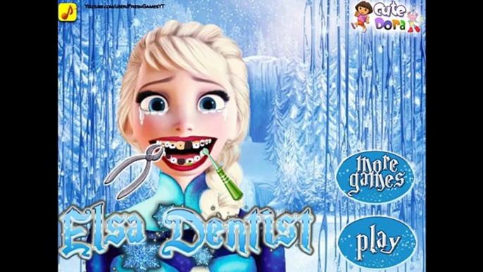 Cavidad dentista para Juegos va en en vamos a en línea jugar para diente Elsa barbie dental