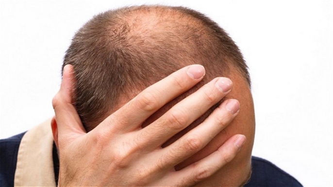 How To Regrow Thinning Hair Naturally.