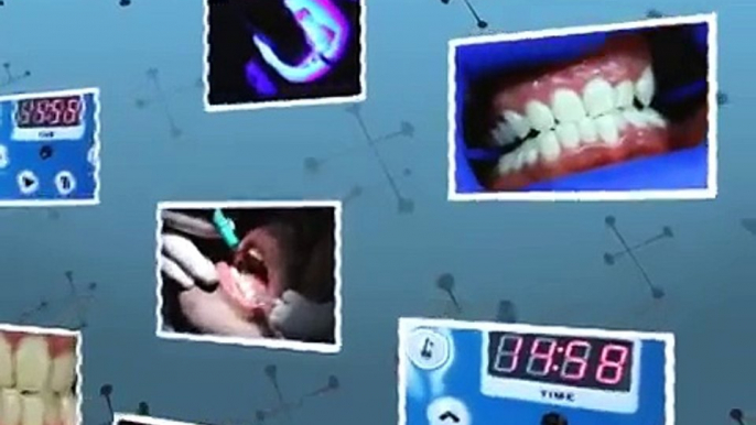 How is Laser Teeth Whitening Done - Teeth whitening in Toronto