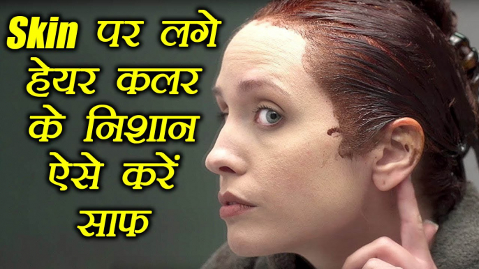 Skin पर लगे हेयर कलर के निशान ऐसे करें साफ, How to get hair dye off your skin | Boldsky