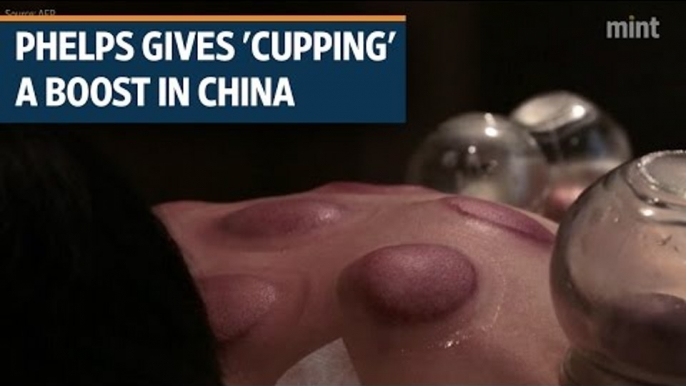 Michael Phelps gives 'cupping' a boost in China