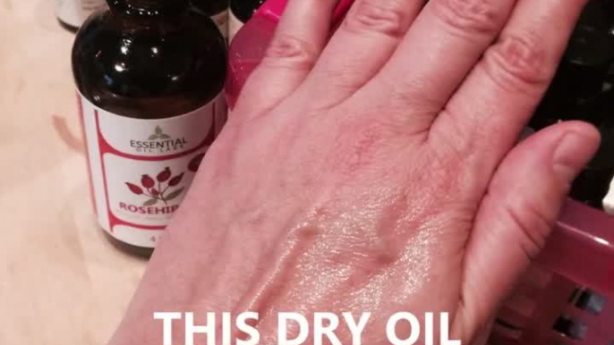 Anti-Aging Oil Cures Cracked Heels, Acne, Wrinkles and Age Spots