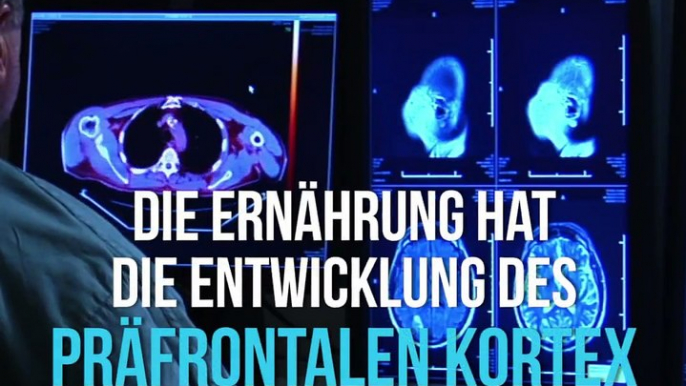 Eine fettreiche Ernährung macht Kinder nicht nur dick, sondern beeinträchtigt auch die korrekte Entwicklung des Gehirns...