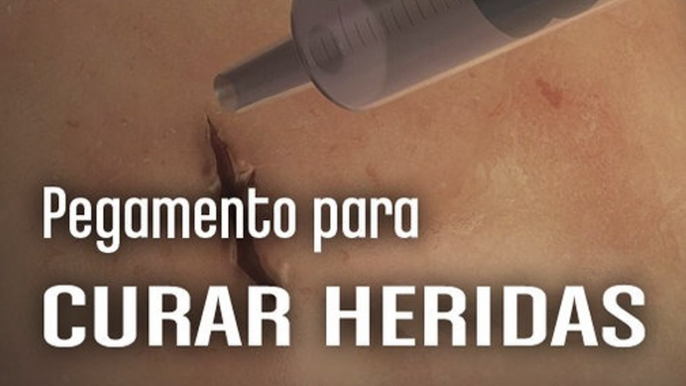 [CH] Pegamento quirúrgico para curar heridas