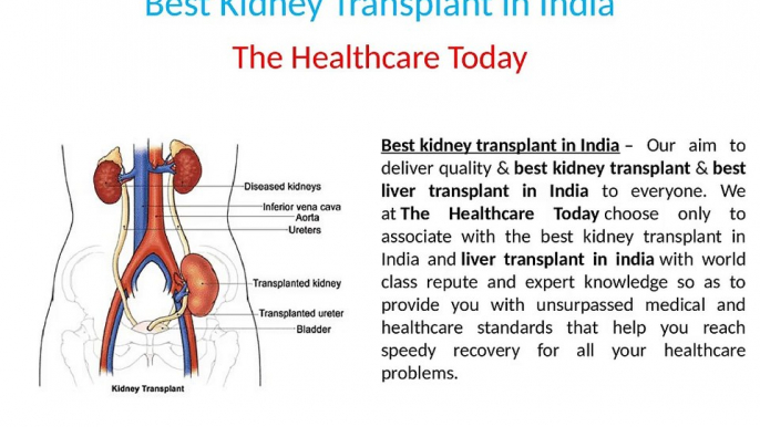 Best Kidney Transplant in India