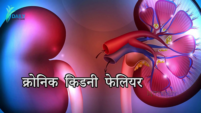 Kidney Failure Signs, Symptoms, Causes and Treatment   Daily Health Care