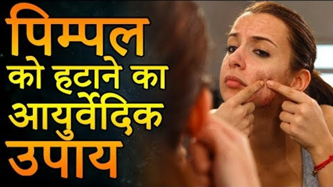 एक ही रात में पिम्पल्स कैसे हटाए | पिम्पल्स को हटाने के आयुर्वेदिक उपाय | Remedies for Pimples