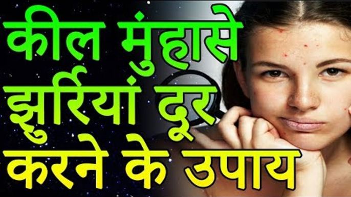 Natural Remedies for Pimples & Skin Problems | कील मुंहासे, दाग, धब्बे तेजी से हटाने का घरेलु उपाय