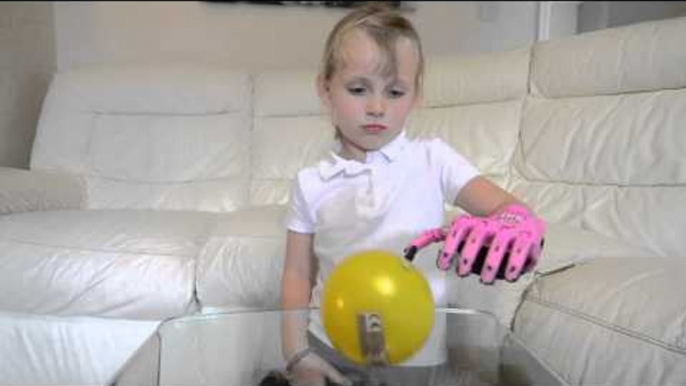 Girl gets super-hero themed prosthetic hand