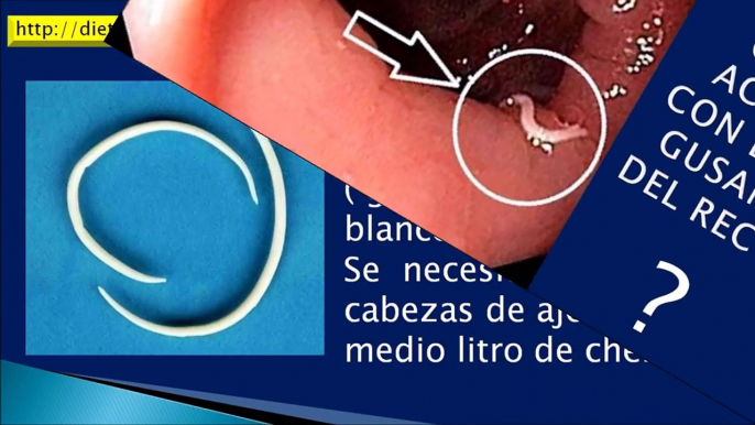 Como Quitar los Gusanos Blancos del Ano ►►OXIUROS◄◄