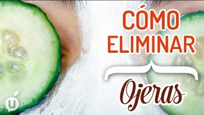 Cómo eliminar las ojeras | Disminuir ojeras e hinchazón | Desaparecer ojeras