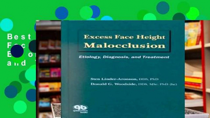 Best product  Excess Face Height Malocclusion: Etiology, Diagnosis and Treatment