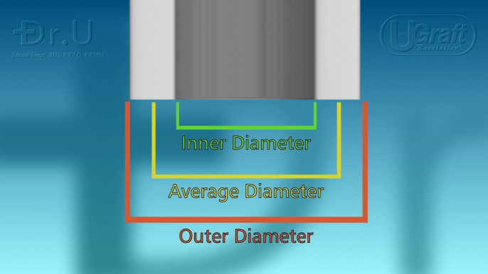 Learn Why Size Matters When it Comes FUE Punches