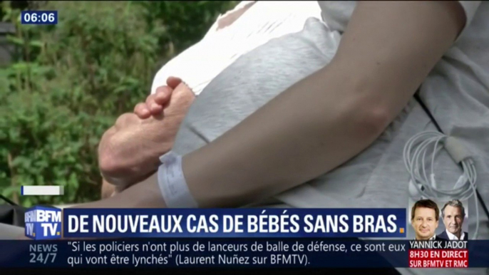 Trois nouveaux cas de bébés sans bras signalés dans les Bouches-du-Rhône