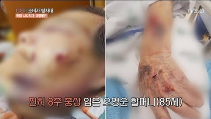 끊이지 않는 요양병원 학대 사건! [CSI 소비자 탐사대 22회] 20180429