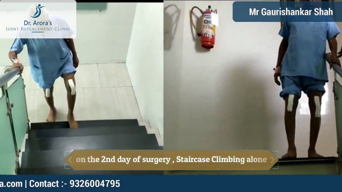 PAINLESS KNEE REPLACEMENT SURGERY | MINIMALLY INVASIVE KNEE REPLACEMENT SURGEON IN THANE | DR BAKUL ARORA