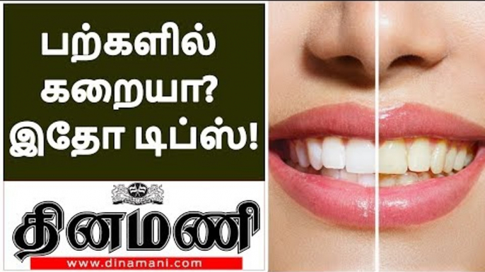 உங்கள் பற்கள் மஞ்சள் நிறத்தில் உள்ளதா? | Removal of Yellow Teeth Stains | teeth whitening in tamil