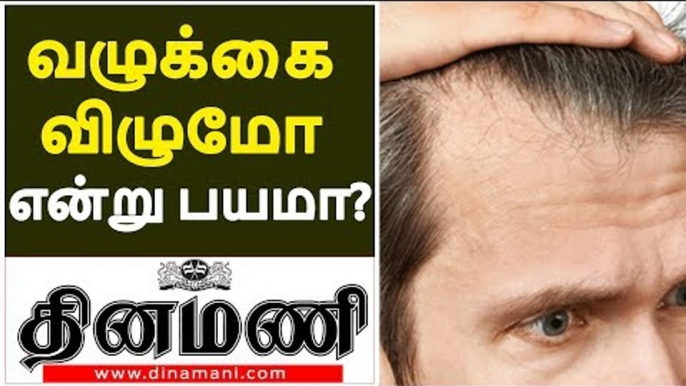 Hair fall Treatment  |  BIGGEST HAIR Fall AND BALDNESS MYTHS REVEALED