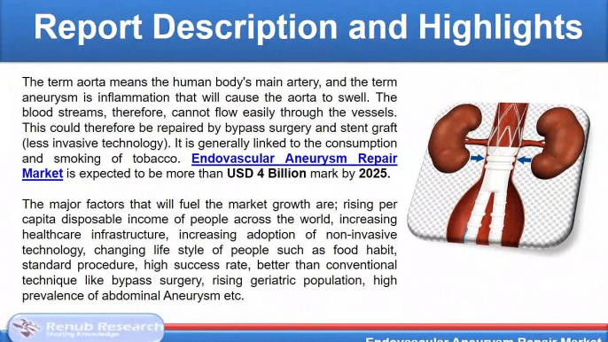 Endovascular Aneurysm Repair Market will be USD 4 Billion by 2025