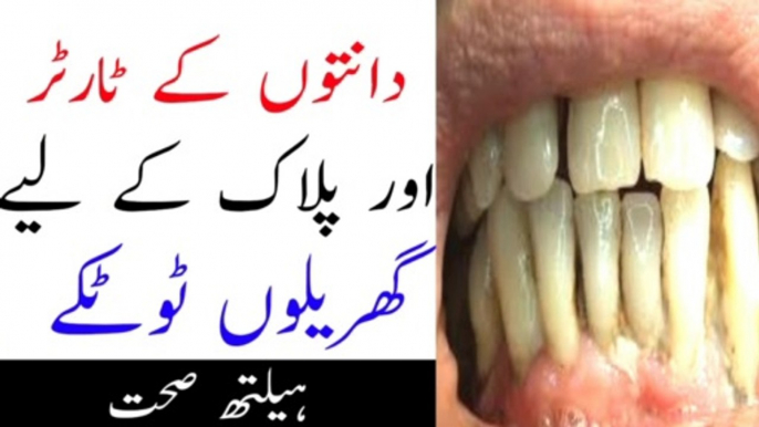 how to whiten teeth with lemon|how to whiten teeth naturally|how to whiten teeth at home