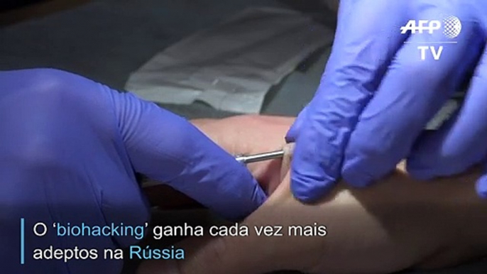 “Biohacking” cada vez mais famoso