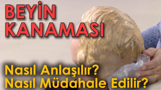 Beyin Kanaması Nasıl Anlaşılır ve Nasıl Müdahale Edilir?