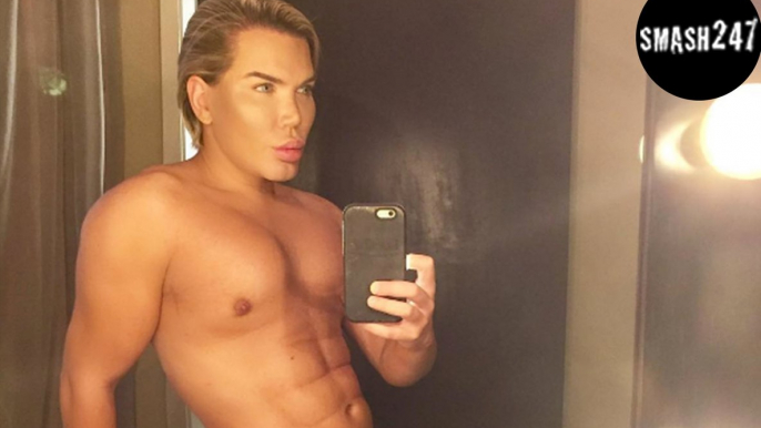 „Real Life Ken“ Rodrigo Alves: Zehnte OP an der Nase, doch sie könnte nun abfallen!