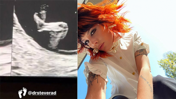 Halsey Shares Her First Sonogram On Instagram; Takes Fans On Her Pregnancy Journey