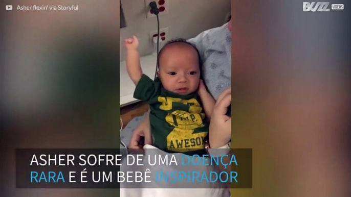 Após 3 cirurgias, bebê com doença rara mostra muque para mãe