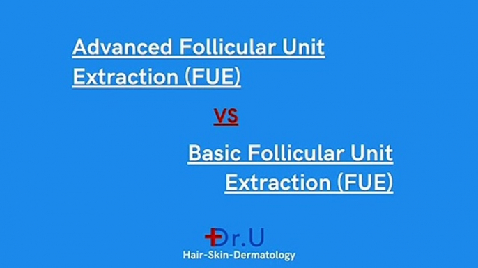 Basic FUE Hair Transplant vs Advanced FUE Hair Transplant