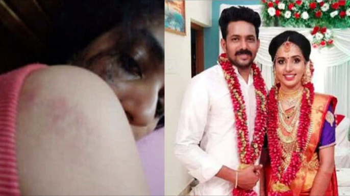 Kerala Dowry Death | Vismaya's SOS Texts Show Her Husband Beat Her, Stamped On Her Face