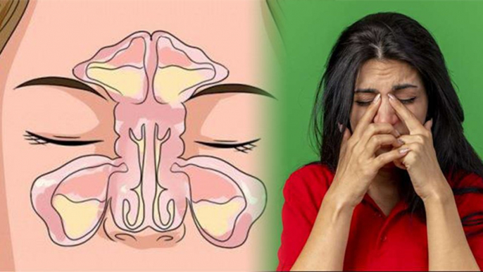 बिना Cold Cough नाक बंद होना कैसे ठीक करें | क्या आपका भी बिना सर्दी नाक बंद होता है | Boldsky