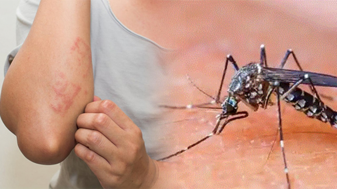 Dengue के New Symptoms चौंकाने वाले, DOCTORS ALERT | Boldsky