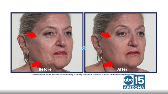 How you can look younger in just 10-minutes with Plexaderm