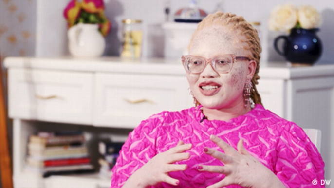 Out of the shadows: Jane Waithera fights discrimination against people with albinism