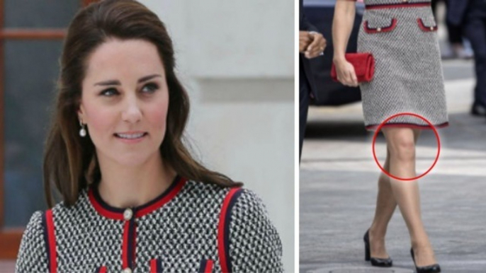 Kate Middleton : les internautes ont vu le visage d'un fantôme se dessiner sur son genou