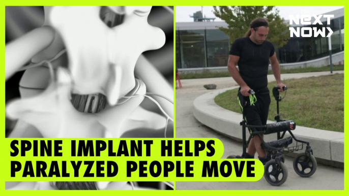 Spine implant helps paralyzed people move | NEXT NOW