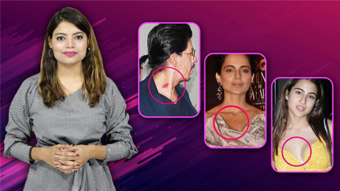 Bollywood Celebrities Love Bites List Viral, Media के सामने Spot हुए ये Actors|Boldsky*Entertainment