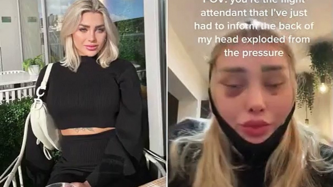 OnlyFans model goes viral after revealing how her 'head exploded' mid-flight - when stitches behind her ear popped open from air pressure following 'cat-eye' surgery in Turkey