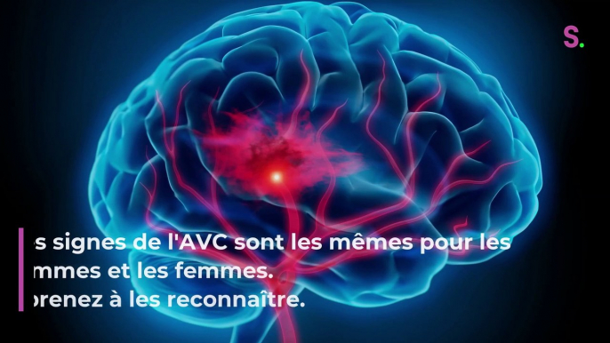 AVC : les 4 signes d'alerte