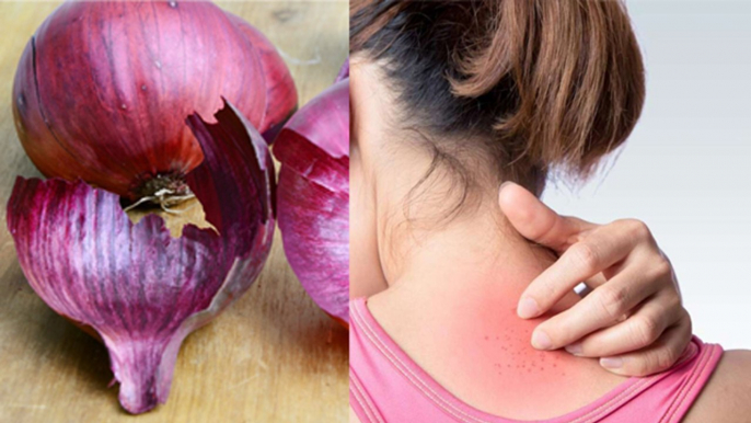 प्याज के छिलके फेंकने से पहले जाने इसके चौकाने वाले फायदे | Benefits Of Onion Peels | Boldsky*Health