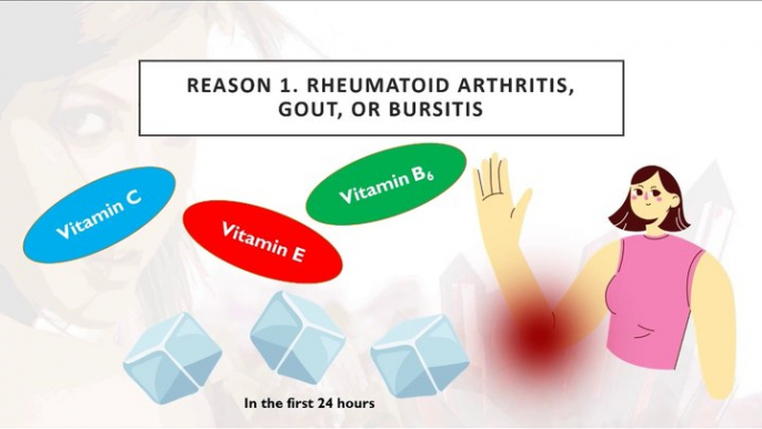 Rheumatoid arthritis, gout or bursitis are causes of arm pain