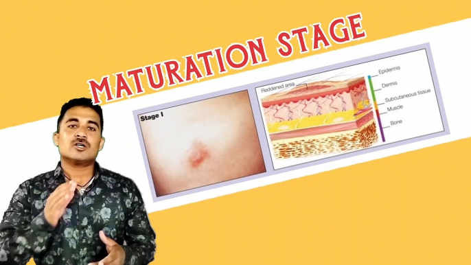 Maturation Stage