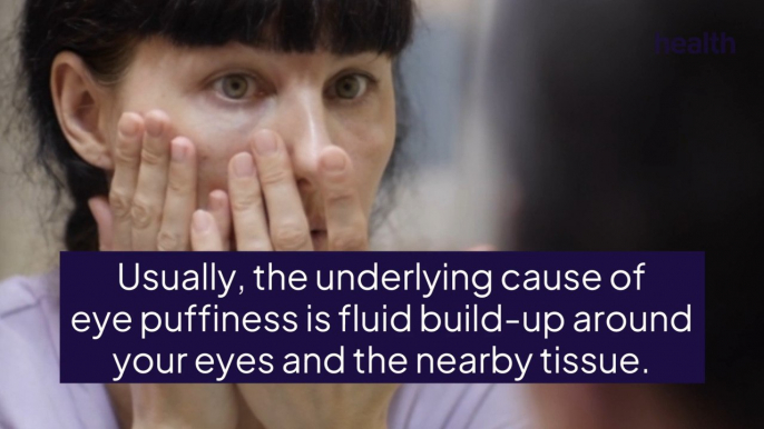 Causes of Eye Bags—And How To Treat Swollen and Puffy Eyes