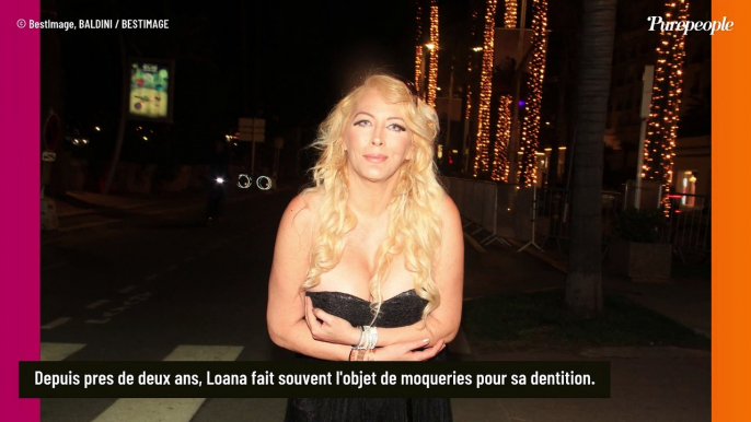 Loana, taxée d'édentée rétablit la vérité sur sa bouche : "ll m'en reste quelques-unes quand même"