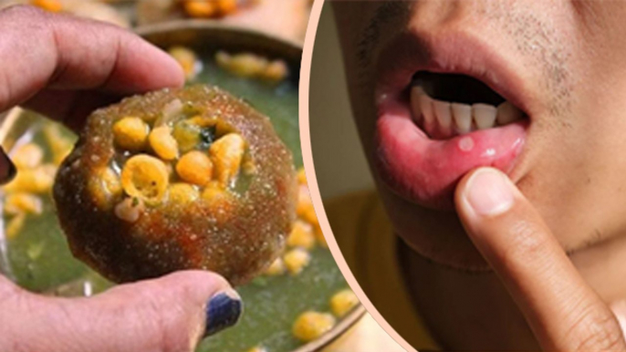 मुंह के छालों में गोलगप्पा खाने से क्या होता है | Mouth Ulcer Me Golgappa Khane Se Kya Hota Hai