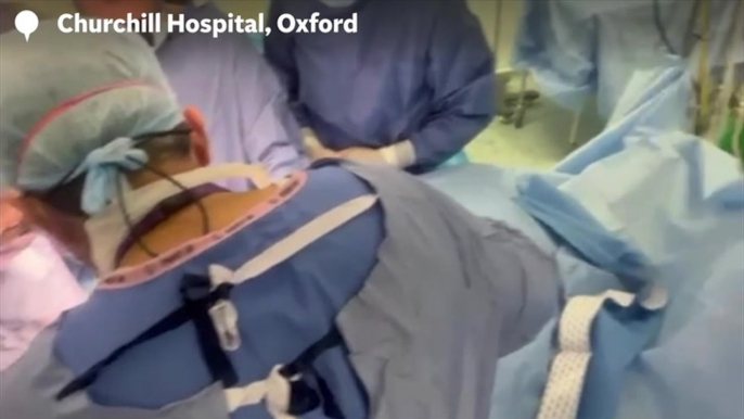 Watch surgeons perform UK’s first womb transplant as woman donates uterus to give sister chance of motherhood